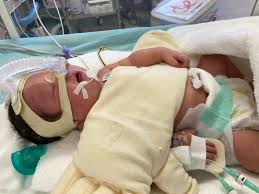 NICUで初面会 | ダウン症&ファロー四徴症(先天性心疾患)・めいちゃんケアのブログ