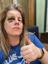 Ugly Bugs ball.. spot the miscreants Jes Simmons Alex Schatunowski Dee  Caldwell....