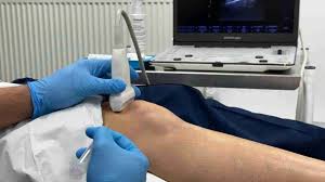 Image result for Prepatellar Bursa Injection