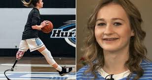 Playing Varsity Basketball With One Prosthetic Leg