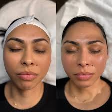 Peyton Davis LE & LLT