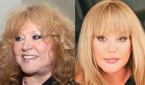 Актриса театра и кино елена проклова поделилась с поклонницами. Elena Proklova Priznalas Chto Poluchaet Udovolstvie Ot Plasticheskih Operacij 22 11 2019 Zvezdy Shou Biznes