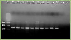 It is a pathogen with worldwide distribution, causing significant financial losses in livestock production. Molecular Identification And Investigations Of Contagious Ecthyma Orf Virus In Small Ruminants North West Ethiopia Bmc Veterinary Research Full Text