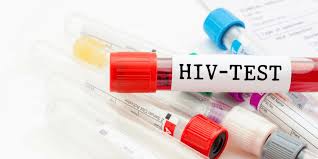 Dalam sesi kaunseling tersebut, bakal pengantin akan didedahkan berkaitan virus. Pengalaman Buat Ujian Saringan Hiv Pra Perkahwinan Di Klinik Kesihatan Tanglin Emilinda