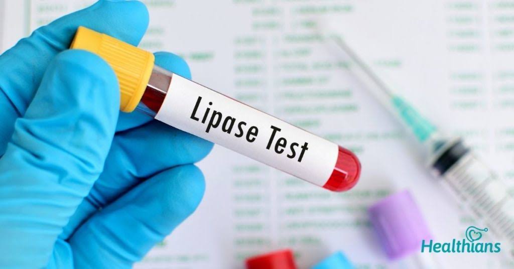 LIPASE product image