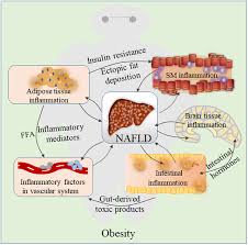 Terrax is a digging tool designed to cut through tree roots, concrete and other obstructions with ease. Inflammation Initiates A Vicious Cycle Between Obesity And Nonalcoholic Fatty Liver Disease Luo 2021 Immunity Inflammation And Disease Wiley Online Library