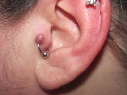 Pin On Home Remedies