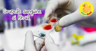 Grupele sanguine si caracterul sistemul rh sistemul rh clasifică sângele uman după prezența sau absența unor proteine specifice pe suprafața hematiilor. Grupele Sanguine Si Rh Ul Desprecopii Com