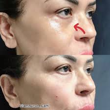 LOS GATOS DERMATOLOGY