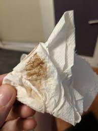 May 18, 2018 · cervical discharge 3 to 4 days after your period ends is dry or not noticeable. Telur Asin Pink Mucus 7 Weeks Pregnant Light Pink Mucus Discharge 7 Weeks Pregnant Pink