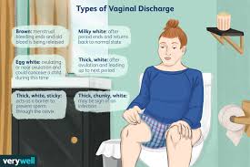Discharge After Period: Causes, Colors, and Treatment