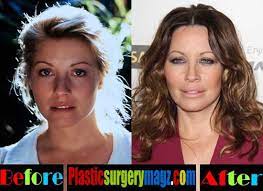 Paul hogan's wife made a recent appearance . Linda Kozlowski Plastic Surgery Before And After Plastic Surgery Magazine In 2021 Plastic Surgery Linda Kozlowski Celebrity Plastic Surgery