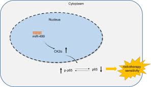 prostate cancer is a disease in which malignant (cancer) cells form in the tissues of the prostate. Microrna 499 Serves As A Sensitizer For Lung Cancer Cells To Radiotherapy By Inhibition Of Ck2a Mediated Phosphorylation Of P65 Molecular Therapy Oncolytics