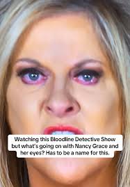 Whats Wrong with Nancy Grace Eyes