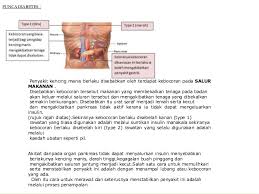 Adakah terdapat cara untuk menghapuskannya? Diabetes Punca Penyakit Kronik Lain