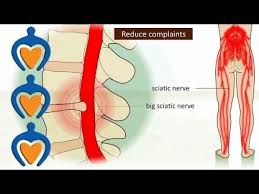 Pin On Lower Back Pain