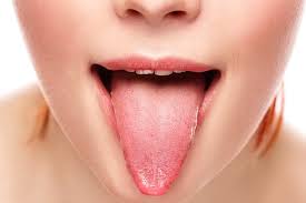 Lingua a fragola = scarlattina. Bruciore Alla Lingua Glossopirosi Cos E Cause E Disturbi Associati
