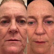 Infused with an innovative blend of marine collagen peptides and powerful botanicals, collagen elixir™ indulges your skin with both beauty and nourishment from the inside out. Collagen Elixir Marine Collagen Peptides Isagenix