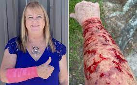 Texan woman badly injured after hawk drops snake from sky