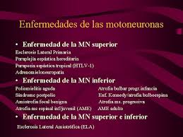 Diferencia entre enfermedades hereditarias y congénitas. Enfermedades De Las Motoneuronas T Sevilla Hospital La
