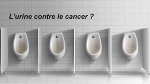 La thérapie par l'urine offre même plusieurs options : L Urine Peut Elle Soigner Le Cancer Dur A Avaler