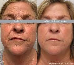 Anti-aging treatment rises to the top