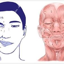 Shows complete recovery of the facial muscles' functionality
