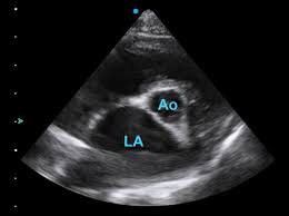 In most cases, the fur must be shaved to perform an ultrasound examination. Veterinary Echocardiography Newsletter 9 The Left Atrium Animal Ultrasound Association