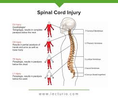 Image result for Spinal Trauma