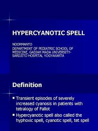 Image result for Tet Spell