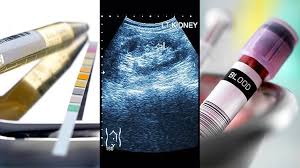 How Doctors Test For Kidney Stones Everyday Health