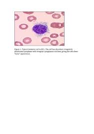 This is why chemotherapy can cause hair loss, anemia, and diarrhea. Hairy Cell Leukemia Cancer Therapy Advisor