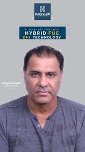 Pakistani Super Model Abdullah Ijaz gets Hair Transplant by Dr. Muhammad  Nasir Rashid at Hair Club. For Consultation: 03041110424 #hairclub  #hairtransplant #abdullahijaz #abdullahejaz #hybridfue #drnasir  #drnasirrashid #nonsurgicalhairreplacement ...