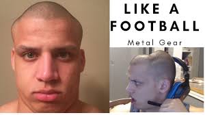 Anthem Tyler1 S Head Dent Youtube