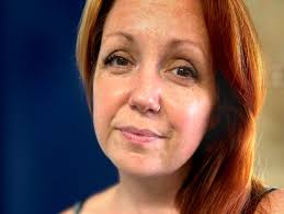 Fundraiser for Daphne Parker Powell by Jenn Glass : Let's help Daphne cover  surgery costs and get well soon!