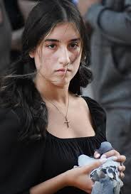 Overdose Awareness Day event in Fall River draws a crowd