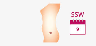 9 Ssw Schwangerschaftswoche Mutter Bauch Baby In 9 Ssw