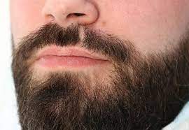 Greffe de barbe tunisie : Greffe De Barbe Reparatrice Medecine Esthetique A Lille Villeneuve D Ascq