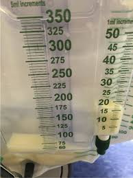 Image result for Urine Output