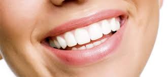 How makeup can help brighten your smile. Teeth Whitening Risks Results Options And Cost Information