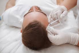Im idealen fall ist die transplantation der haare mit nur einem einzigen operativen eingriff abgeschlossen. Haartransplantation Alternative Sinnvoll First Hair Clinic