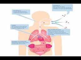 Pathophysiology Of Mesothelioma Youtube