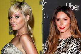 The kelly rowland nose job must have occurred after 2001, while she was still high flying with destiny's child. Ashley Tisdale Reflects On Nose Job Scrutiny