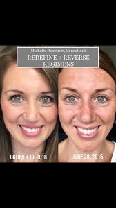 Look at This transformation…Thanks for sharing Kimberly Majestic Stoker 🌸  “My skin still isn't perfect, but with years of consistency and what I like  to call big girl skincare my skin is