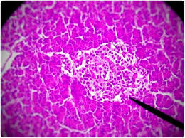 You don't want the children to be board in their new hobbya and they will be listening for. Labelling Pancreatic Islets For Transplantation Using Nmr
