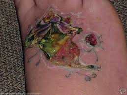 Pin On Bad Tattoo Ideas
