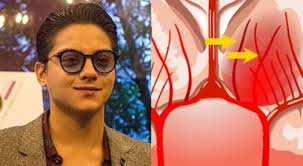 Alma sinakmal ng alagang aso; ibinahagi natutuhan tungkol sa anti-rabies  shots-Balita