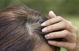 La colorazione ai capelli permette di sfoggiare la chioma come meglio si desidera, bionda, rossa, nera e così via. La Dieta Per Prevenire E Curare I Capelli Bianchi Tagmedicina Giornale Medico On Line Salute Benessere Prevenzione E Aggiornamenti Del Settore Medico