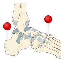 Get it as soon as thu, jun 3. Anatomy Of Lower Extremity