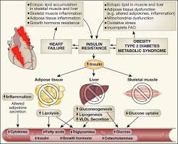It can be caused by a variety of reasons. Insulin Signaling And Heart Failure Circulation Research